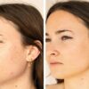 Sérum anti imperfections – Image 2
